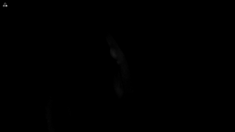 ICG fluorescence imaging of laryngeal tissue